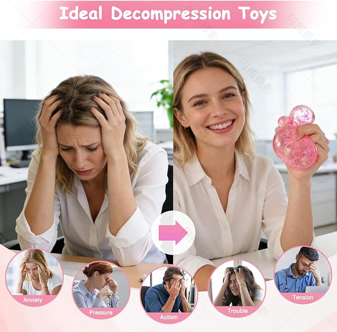 Sugar Dumpling Squishy, Glitter Squishies Dumpling Mystery Box, Viral Bao Bun Squeeze Toy,Stress Relief Fidget Toys (Pink)