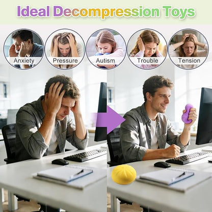 Dumpling Squishy Mystery Box, Dumplings Squeeze Stress Balls for Kids & Adults, Sensory Fidget Toys for Anxiety Relief, Crazy Fun Squishy Dumpling Ideal Gift for Boys,Girls,Teens(White)